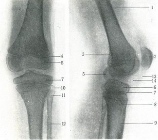 задній і бічній знімки колінного суглоба