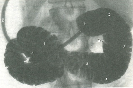 рентгенограма дванадцятипалої кишки