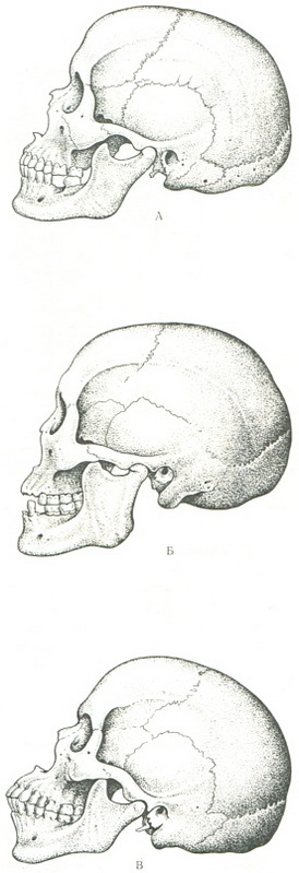 расові особливості форми черепа