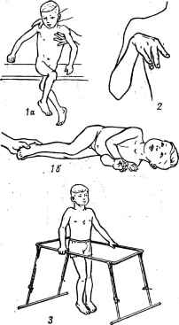 гімнастика при дитячому церебральному паралічі