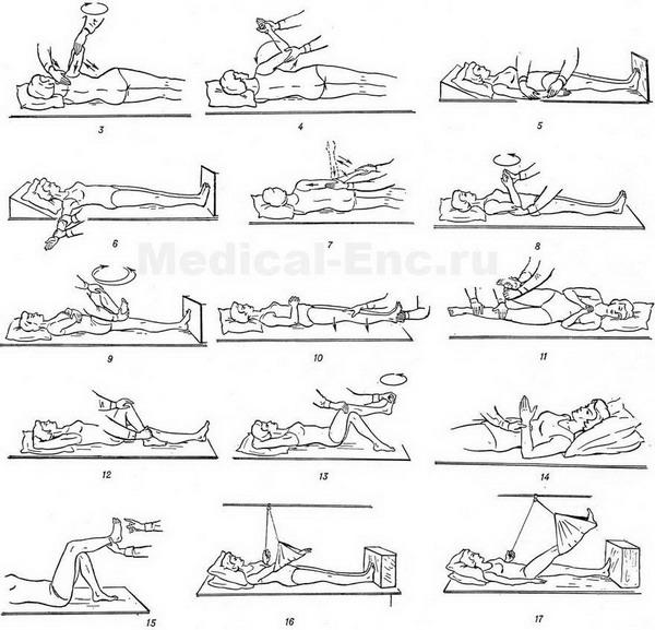 лікувальна гімнастика при центральних паралічах
