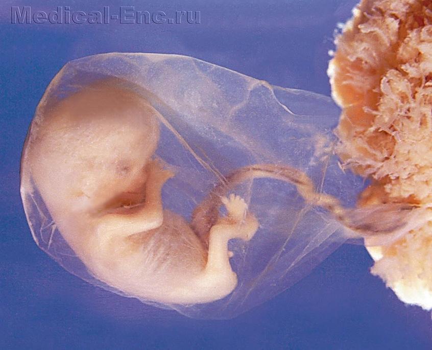 зародок ембріон людини