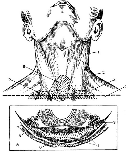 надгрудинное клітковинний простір (схеми)