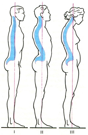 варіанти фізіологічних вигинів хребта