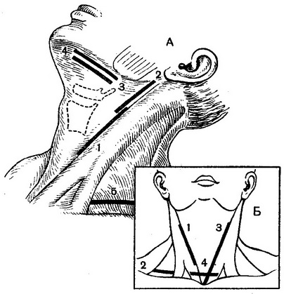 розрізи на шиї