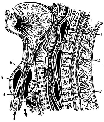 розташування абсцесів шиї схема
