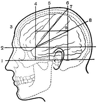 проекційна схема черепа за Кронлейну - Брюсовой