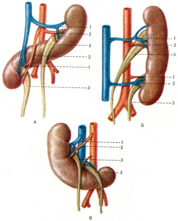 аномалія розвитку нирок