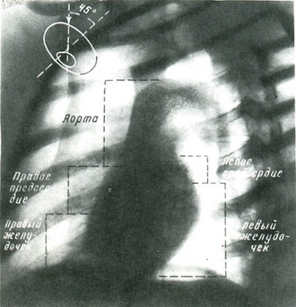 знімки серця і великих судин