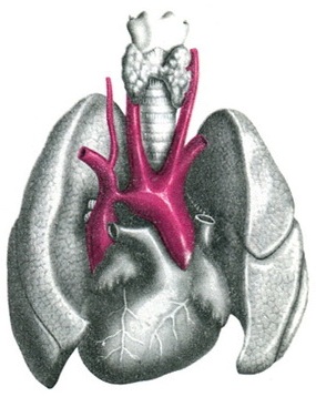 звуження аорти