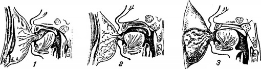 смоктальний акт у немовляти