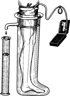 плетизмометр