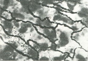 ендотеліальні клітини лімфатичних судин