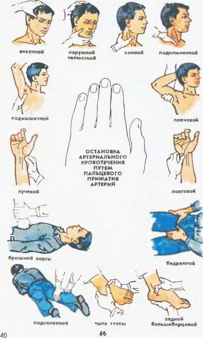 зупинка артеріальної кровотечі шляхом пальцевого притиснення артерій
