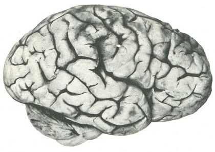 рельєф півкулі мозку новонародженого