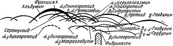 иммуноэлектрофорез нормальної сироватки крові