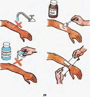 обробка ран