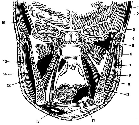 схема локалізації запальних процесів в області гілок нижньої щелепи і верхнього відділу глотки