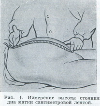 вимір