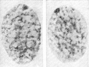 статевий хроматин