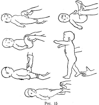 вправи при вродженій клишоногості