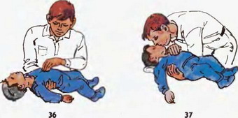 масаж серця дітям