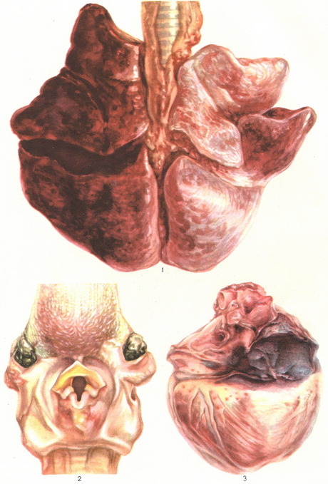 гостра променева хвороба